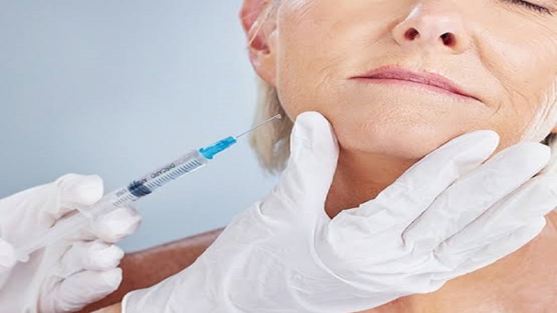 فیلر pre-jowl برای اصلاح افتادگی پایین صورت