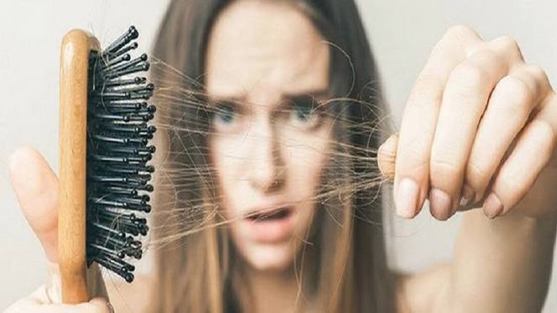 چرا خانم‌های جوان دچار ریزش مو می‌شوند؟