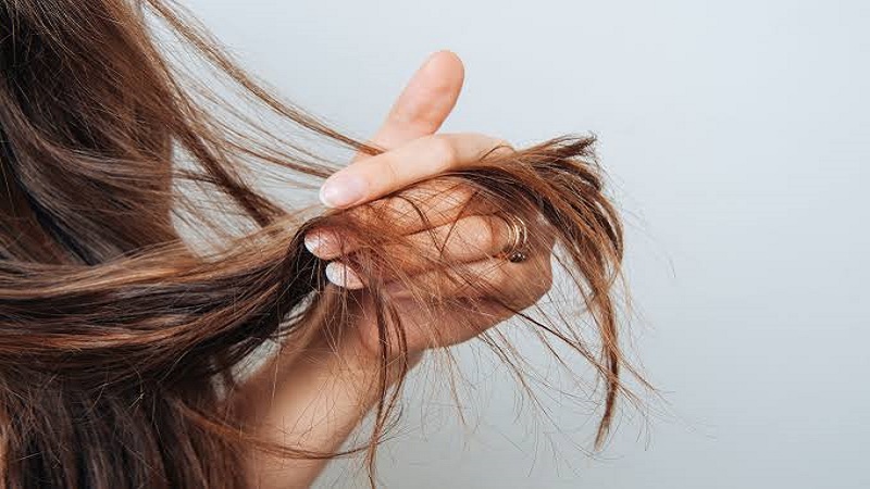 ریزش مو و سبک زندگی در شهرهای خشک مثل اصفهان